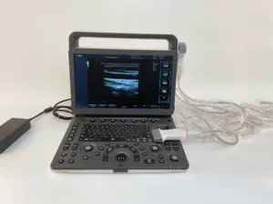Best Price CW TDI PDI Handheld Portable Ultrasonido 3D 4D Veterinary Doppler Ultrasound Machine