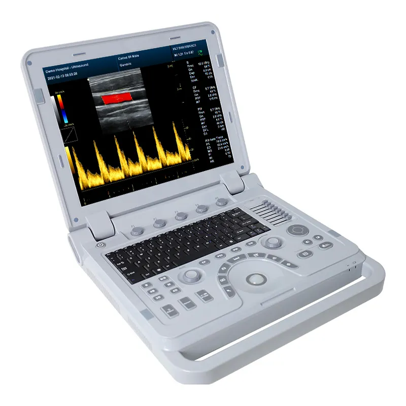 CONTEC CMS1700B-VET Alat Kedokteran Hewan untuk Detektor Tes Kehamilan Pemindai Ultrasound Portabel V16