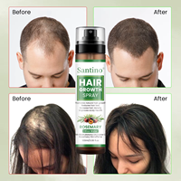 Semprotan Rambut Air Beras Rosemary Label Pribadi Dengan Biotin, Minyak Jarak, Minyak Batana, Menutrisi Akar Rambut, Anti Rambut Rontok