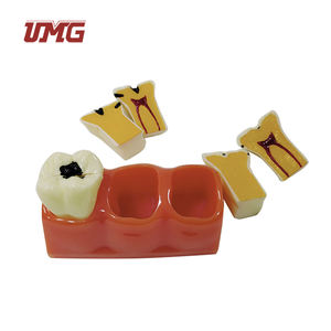 Modelo educativo de ciencia médica, modelo de desmontaje de caries de tamaño 4 veces - Product Image 4