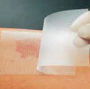 Feuille de gel de silicone Yafho, silicone <span class=keywords><strong>double</strong></span> face pour la surface de la <span class=keywords><strong>peau</strong></span>, 7,5*10 cm, dispositif médical OEM - Product Image 5