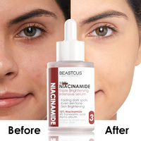 Sérum éclaircissant professionnel 10% niacinamide avec 4% d'acide tranexamique et d'arbutine pour le sérum de soin de la peau du visage
