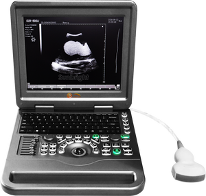 ציוד אולטרסאונד נייד רב לשוני/w ציוד אולטרסאונד אולטרסאונד אבחון רפואי - Product Image 3