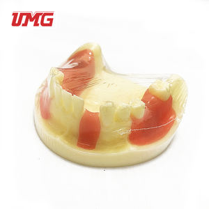 Aides pédagogiques dentaires Modèle de formation aux implants dentaires - Product Image 3