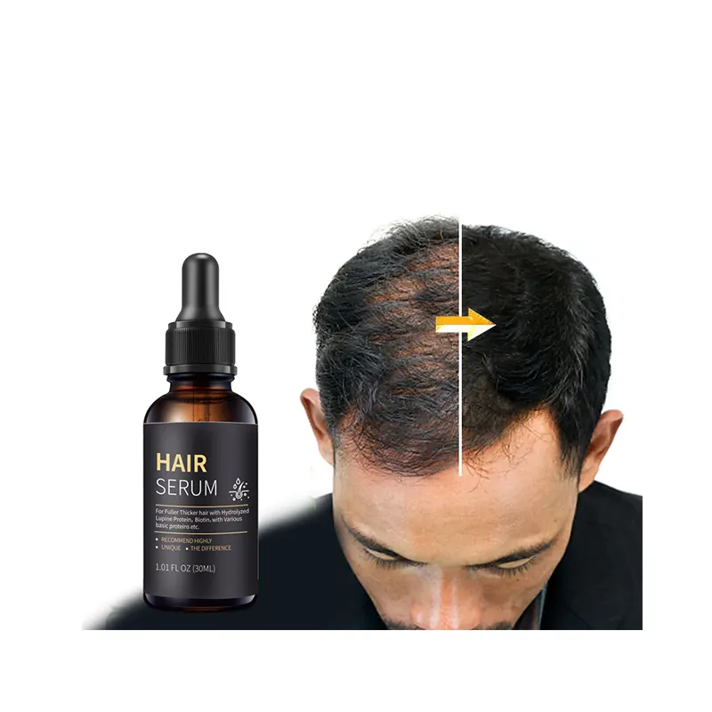 Fabrika fiyat özel etiket siyah tohum hint yağı saç büyüme Serum kalın saç hızlı büyüme tedavisi Serum