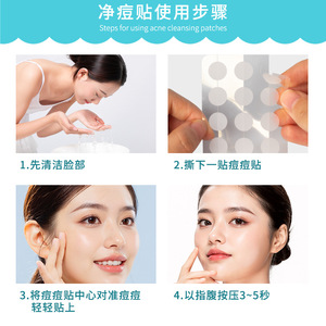 Patch anti-acné en forme d'étoile, patch coloré pour le traitement de l'acné - Product Image 4