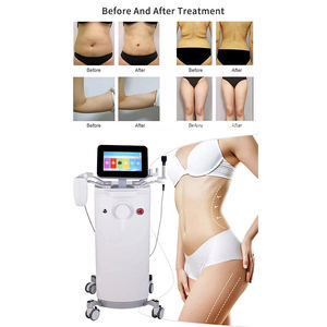 Appareil de remodelage corporel 2-en-1 InModes Pro Minfx pour le raffermissement de la peau et l'élimination de la cellulite, machine de remodelage corporel RF BodyFX Forma - Product Image 4