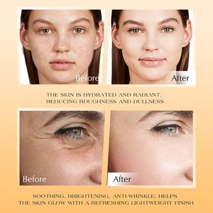 Tonique facial à l'acide glycolique, au curcuma et au riz, anti-acné, améliore les imperfections et l'acné, tonique pour la peau, rafraîchissant et hydratant - Product Image 5