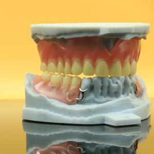 Metaal 3D-dentale print, compact en stevig, gemaakt van kobalt-chroomlegering - Product Image 3