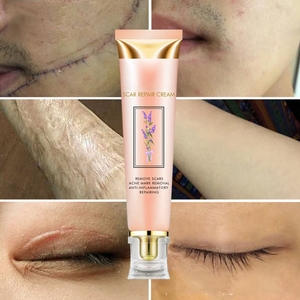 Hidratante hidratante Premium para el cuidado de la piel ordinaria para la eliminación de cicatrices de acné fórmula nutritiva para todo tipo de piel - Product Image 1