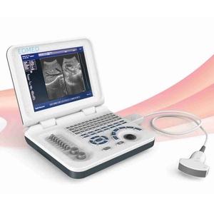 Système de diagnostic par ultrasons portable, scanner d'échographie pour la grossesse, appareil d'échographie cardiaque, échographie vétérinaire BW27 - Product Image 1