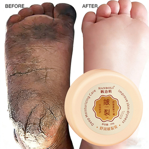 Crema Riparatrice per Piedi con Logo Personalizzato, Basso MOQ, Anti-Secchezza e Screpolature, Idratante Intensiva e Sbiancante - Product Image 1