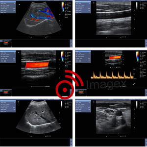 Máquina <span class=keywords><strong>de</strong></span> ultrasonido veterinario portátil para imágenes abdominales <span class=keywords><strong>de</strong></span> animales pequeños - Product Image 4