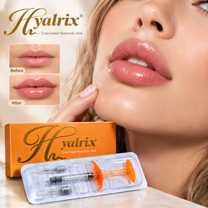 Relleno Dérmico Labial Seguro y <span class=keywords><strong>de</strong></span> Alta Calidad para una <span class=keywords><strong>Aumento</strong></span> Labial Sutil, para Obtener <span class=keywords><strong>Labios</strong></span> Voluminosos y Suaves <span class=keywords><strong>con</strong></span> una Textura Natural - Product Image 1