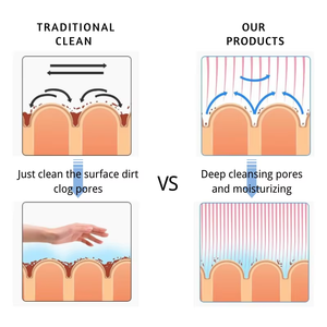 Limpiador Facial de Burbujas de Hidrógeno y Oxígeno, Removedor de Puntos Negros, Máquina Facial Portátil para Hidratación de la Piel - Product Image 2
