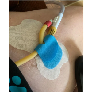 Kateter <span class=keywords><strong>Foley</strong></span> uretra steril medis sekali pakai, perangkat fiksasi dasar non-tenun dengan pemegang kateter tipe disinfektan EOS - Product Image 6