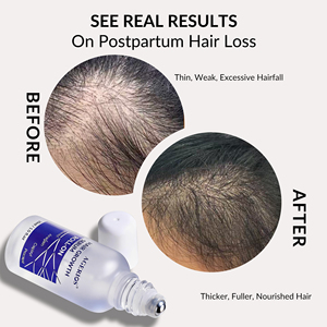 Serum Penumbuh Rambut Konsentrat 3% Redensyl Anagain Baicapil, Kafein, <span class=keywords><strong>Biotin</strong></span>, Berbasis Tumbuhan MENGATURKAN PERTUMBUHAN RAMBUT & MENGURANGI RONTOKAN RAMBUT - Product Image 5