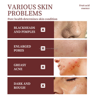 Privé Label AHA+BHA Fruitzuur Anti-Acne Gezichtserum Oplossing Exfolierend Verkleint Porien Verheldert Verlicht Huidverzorging Serum