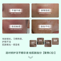 Vente d'usine acide hyaluronique Niacinamide Peptides ensemble de liquide lyophilisé élimination des rides blanchissant Anti-âge raffermissant