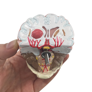 Анатомические модели для демонстрации диабета - Product Image 6