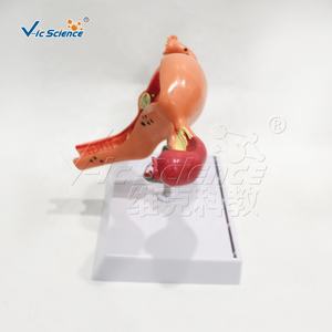 Modèles utérins normaux <span class=keywords><strong>et</strong></span> pathologiques, modè<span class=keywords><strong>le</strong></span> d'enseignement en sciences médicales, modèles anatomiques <span class=keywords><strong>et</strong></span> médicaux - Product Image 3