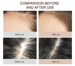 100% Pur Naturel Cheveux Shampooing Anti-Perte <span class=keywords><strong>De</strong></span> cheveux Shampooing Au <span class=keywords><strong>Gingembre</strong></span>, shampooing et revitalisant - Product Image 6