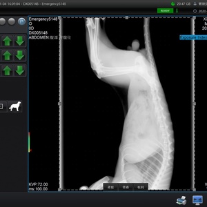 Detektor Panel Datar Manual Iray 17*17 Detektor Panel Datar Nirkabel Iray Mesin Rontgen 1717 Otomatis Penuh <span class=keywords><strong>Dr</strong></span> Tech - Product Image 6