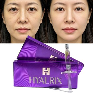 Hyalrix Deep 1.1ml Cross Linked <strong>Hyaluronic</strong> <strong>Acid</strong> Dermal Filler for Cheek <strong>Jawline</strong> Deep Volume Restoration Facial Contour <strong>Injection</strong> - Product Image 1