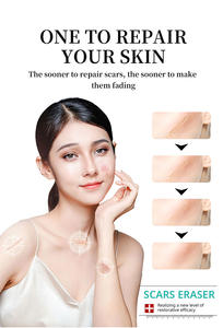 Ungüento MAYCHEER para la Decoloración de la Piel Postoperatoria por Quemaduras - Product Image 5