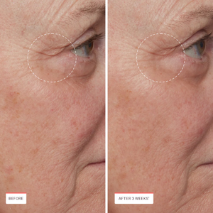 Sérum Raffermissant au Cuivre et Peptides OEM ODM - Sérum Visage Anti-Âge pour Rides et Peau Relâchée, Stimulant de Collagène, Alternative au Rétinol - Product Image 5