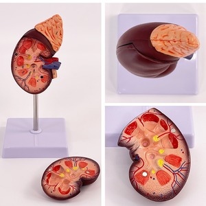 Modèle de simulation rénale pour l'enseignement, modèle de rein humain naturel à l'échelle 1:1, anatomie viscérale. - Product Image 1