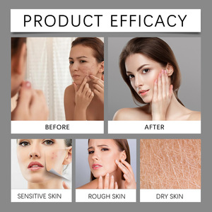 ครีมบำรุงผิวพร้อมฮอร์โมนบรรเทาอาการปวดประจำเดือนประจำเดือน - Product Image 2