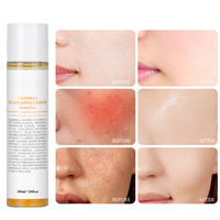 Tonique Hydratant Non Gras à l'Extrait de Calendula pour Peaux Grasses, Blanchissant et Biologique, Marque Privée du Fabricant
