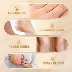 Krim Urea Label pribadi dengan krim kaki asam salisilat 2% pelembap kekuatan maksimum untuk perawatan kulit kaki retak & kering - Product Image 6