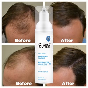 Sérum de repousse des cheveux pour hommes, mousse de croissance des cheveux - Product Image 2