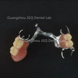 Dentaduras removibles <span class=keywords><strong>de</strong></span> alta calidad con marco <span class=keywords><strong>de</strong></span> metal y dientes acrílicos para prótesis dentales duraderas <span class=keywords><strong>Precio</strong></span> asequible - Product Image 2