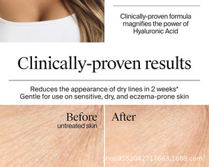 Crème hydratante intense apaisante et nourrissante pour une peau éclatante, soutien de la barrière cutanée, crème <span class=keywords><strong>gel</strong></span> hydratante à l'acide hyaluronique, OEM OBM - Product Image 3