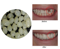 4 couleurs Nouvelle restauration dentaire Faux dents Réparation de dents Perfect Smile Facettes Comfort Fit Flex Dentiers Bretelles Adhésifs Colle