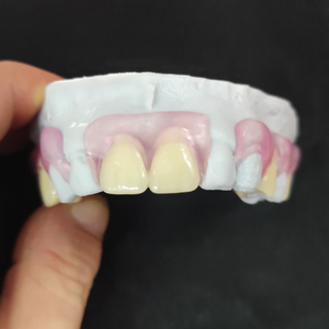 Dentiers amovibles Valplast, prix du laboratoire dentaire en Chine, dentiers flexibles en acrylique, dentiers amovibles RPD avec dents artificielles en acrylique - Product Image 2