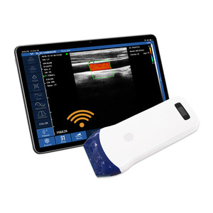 Sonde d'échographie couleur sans fil CProbe-5L, scanner à ultrasons linéaire, sondes <span class=keywords><strong>USG</strong></span> portables pour smartphone - Product Image 3