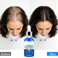 Sérum de croissance capillaire naturel et biologique, soin hydratant et apaisant efficace pour le cuir chevelu, sérum de soin du cuir chevelu au peptide de cuivre bleu GHK-CU