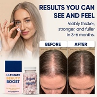 Compléments capillaires Hair Boost : Vitamines pour cheveux, peau et ongles avec biotine et minéraux pour la santé des cheveux - Cheveux plus épais - 60 capsules