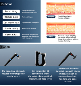 เครื่องกายภาพบำบัดความงามรุ่นล่าสุด 448K พร้อมเทคโนโลยีลูกกลิ้งเพื่อบรรเทาอาการปวดและดูแลผิวในร้านเสริมสวย - Product Image 6