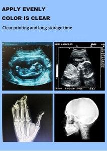 Japón importó un material de grado Impresión clara Ultrasonido 110HD Grabadora de video Electro Impresora Papel térmico de la UPP-110S de UPP-110HG - Product Image 5