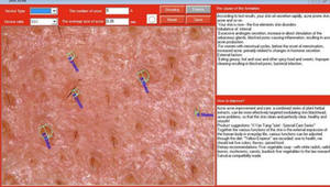 Mini análisis de prueba de piel, analizador de piel facial, máquina de escáner de piel <span class=keywords><strong>para</strong></span> la piel - Product Image 5