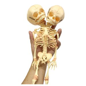 Abnormaal foetaal skelet, dubbelkoppig mannequinmodel voor medisch onderwijs door Henan Yulin - Product Image 2