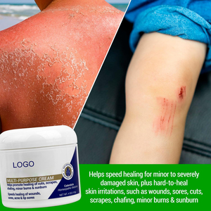 Crema Multiusos de Marca Privada que <span class=keywords><strong>Ayuda</strong></span> <span class=keywords><strong>a</strong></span> Promover la Curación de Cortes, Rasguños, Rozaduras, Quemaduras Menores y Quemaduras Solares - Product Image 2