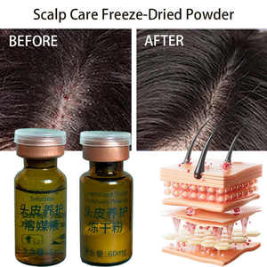 M Organic Anti-Dandruff Repair Powder alivia la picazón nutre el cuero cabelludo trata la <span class=keywords><strong>dermatitis</strong></span> seborreica mejora los folículos pilosos - Product Image 3