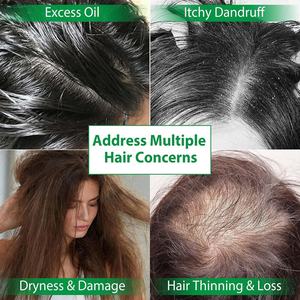 LANCER KING 300ml Acondicionador Capilar de Aceite de Batana Natural y Orgánico de Marca Privada, Apto para Hombres y Mujeres - Product Image 3