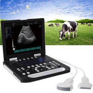 Échographe Doppler Couleur Portable pour Hôpital avec Sonde, Meilleur <span class=keywords><strong>Prix</strong></span>, Échographie 3D 4D, <span class=keywords><strong>Machine</strong></span> à Ultrasons Portable pour Grossesse Humaine - Product Image 1